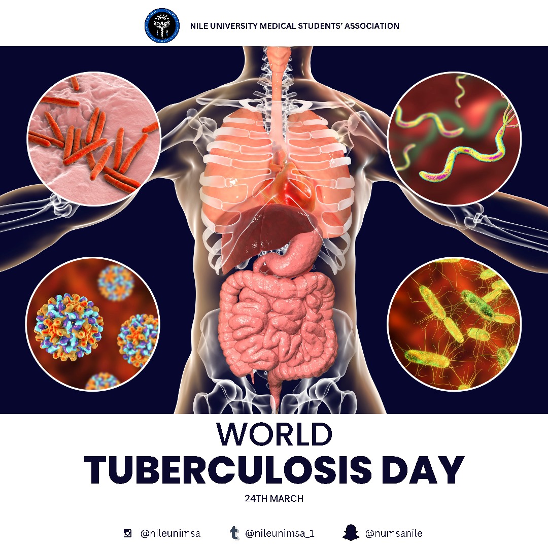 On World Tuberculosis Day, it’s crucial to highlight several key points...